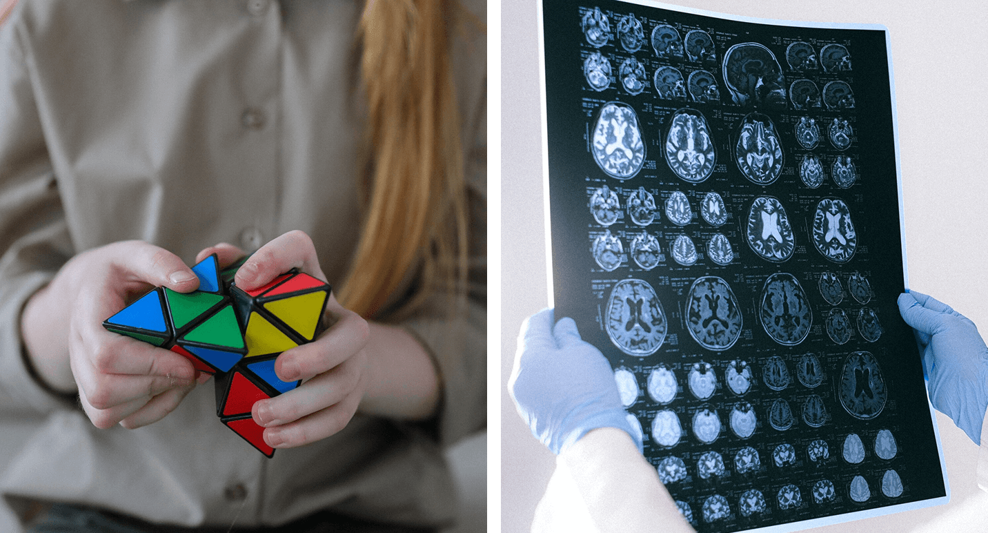 A split-screen image. The left side shows a close-up of hands manipulating a colorful pyramid-shaped mechanical puzzle, representing the active cognitive testing phase. The right side shows a person in blue medical gloves holding up a sheet of brain MRI scans, symbolizing clinical accuracy. Together, they illustrate the importance of test hygiene in ensuring reliable results.